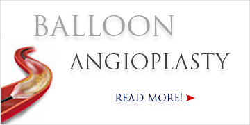 Balloon Angioplasty - Vanda Rossen