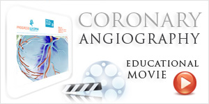 Coronary Angiography - Vanda Rossen